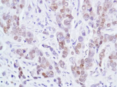 Immunohistochemistry (Formalin/PFA-fixed paraffin-embedded sections) - Anti-Androgen Receptor antibody [SP107] - BSA and Azide free (AB236225)