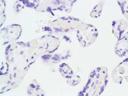 Immunohistochemistry (Formalin/PFA-fixed paraffin-embedded sections) - Anti-Androgen Receptor antibody [SP107] - BSA and Azide free (AB236225)