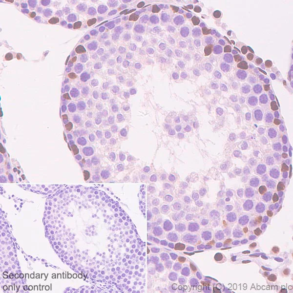 Immunohistochemistry (Formalin/PFA-fixed paraffin-embedded sections) - Anti-Androgen Receptor antibody [SP107] - BSA and Azide free (AB236225)