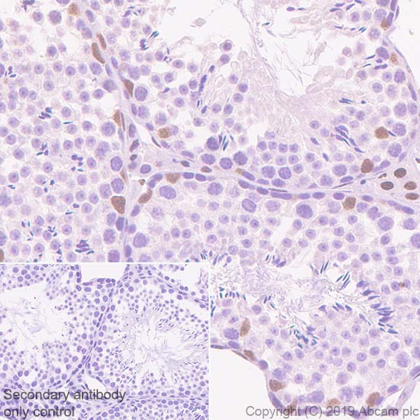 Immunohistochemistry (Formalin/PFA-fixed paraffin-embedded sections) - Anti-Androgen Receptor antibody [SP107] - BSA and Azide free (AB236225), expandable thumbnail