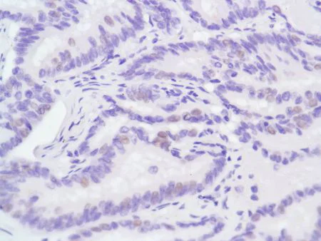 Immunohistochemistry (Formalin/PFA-fixed paraffin-embedded sections) - Anti-Androgen Receptor antibody [SP107] - BSA and Azide free (AB236225)