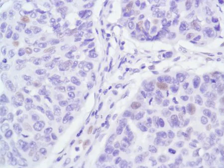 Immunohistochemistry (Formalin/PFA-fixed paraffin-embedded sections) - Anti-Androgen Receptor antibody [SP107] - BSA and Azide free (AB236225)