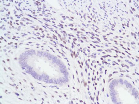 Immunohistochemistry (Formalin/PFA-fixed paraffin-embedded sections) - Anti-Androgen Receptor antibody [SP107] - N-terminal (ab105225), expandable thumbnail