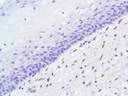 Immunohistochemistry (Formalin/PFA-fixed paraffin-embedded sections) - Anti-Androgen Receptor antibody [SP107] - N-terminal (ab105225), expandable thumbnail