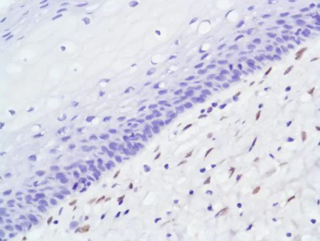 Immunohistochemistry (Formalin/PFA-fixed paraffin-embedded sections) - Anti-Androgen Receptor antibody [SP107] - N-terminal (AB105225)