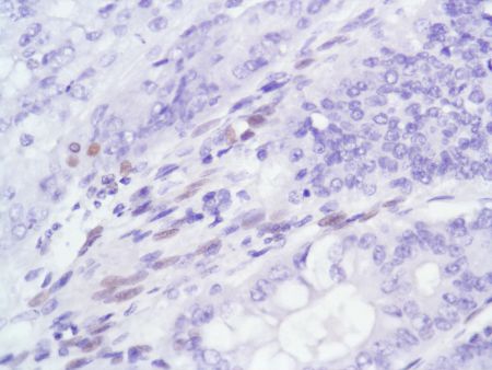 Immunohistochemistry (Formalin/PFA-fixed paraffin-embedded sections) - Anti-Androgen Receptor antibody [SP107] - N-terminal (ab105225), expandable thumbnail