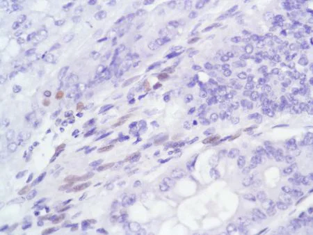 Immunohistochemistry (Formalin/PFA-fixed paraffin-embedded sections) - Anti-Androgen Receptor antibody [SP107] - N-terminal (AB105225)