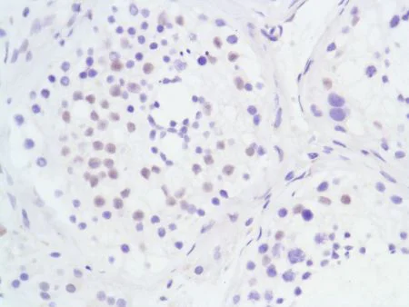 Immunohistochemistry (Formalin/PFA-fixed paraffin-embedded sections) - Anti-Androgen Receptor antibody [SP107] - N-terminal (AB105225)
