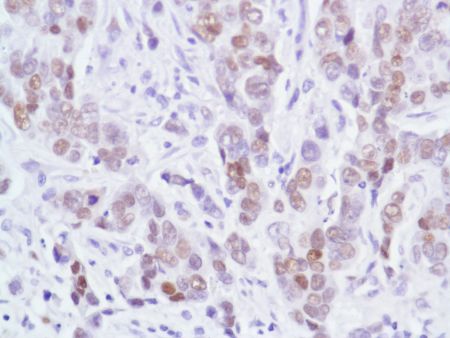 Immunohistochemistry (Formalin/PFA-fixed paraffin-embedded sections) - Anti-Androgen Receptor antibody [SP107] - N-terminal (ab105225), expandable thumbnail