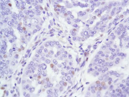 Immunohistochemistry (Formalin/PFA-fixed paraffin-embedded sections) - Anti-Androgen Receptor antibody [SP107] - N-terminal (AB105225)