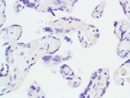 Immunohistochemistry (Formalin/PFA-fixed paraffin-embedded sections) - Anti-Androgen Receptor antibody [SP107] - N-terminal (ab105225), expandable thumbnail