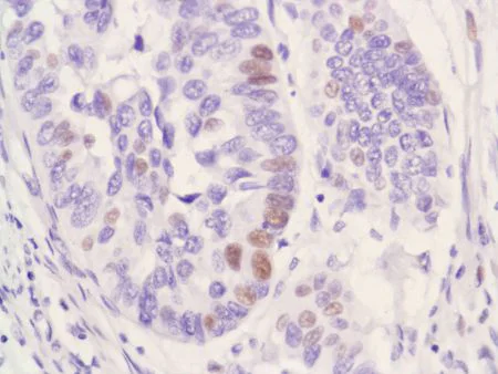 Immunohistochemistry (Formalin/PFA-fixed paraffin-embedded sections) - Anti-Androgen Receptor antibody [SP107] - N-terminal (AB105225)