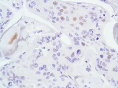 Immunohistochemistry (Formalin/PFA-fixed paraffin-embedded sections) - Anti-Androgen Receptor antibody [SP107] - N-terminal (AB105225)