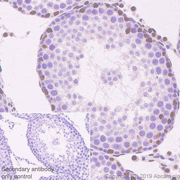 Immunohistochemistry (Formalin/PFA-fixed paraffin-embedded sections) - Anti-Androgen Receptor antibody [SP107] - N-terminal (AB105225), expandable thumbnail