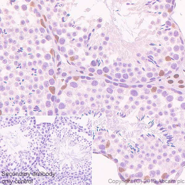 Immunohistochemistry (Formalin/PFA-fixed paraffin-embedded sections) - Anti-Androgen Receptor antibody [SP107] - N-terminal (AB105225)