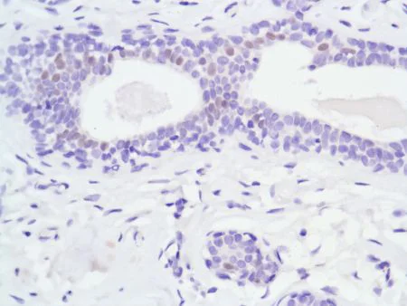 Immunohistochemistry (Formalin/PFA-fixed paraffin-embedded sections) - Anti-Androgen Receptor antibody [SP107] - N-terminal (AB105225)