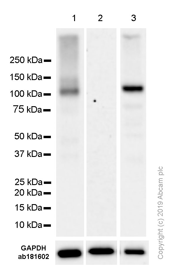Western blot - Anti-Androgen Receptor antibody [SP107] - N-terminal (AB105225), expandable thumbnail
