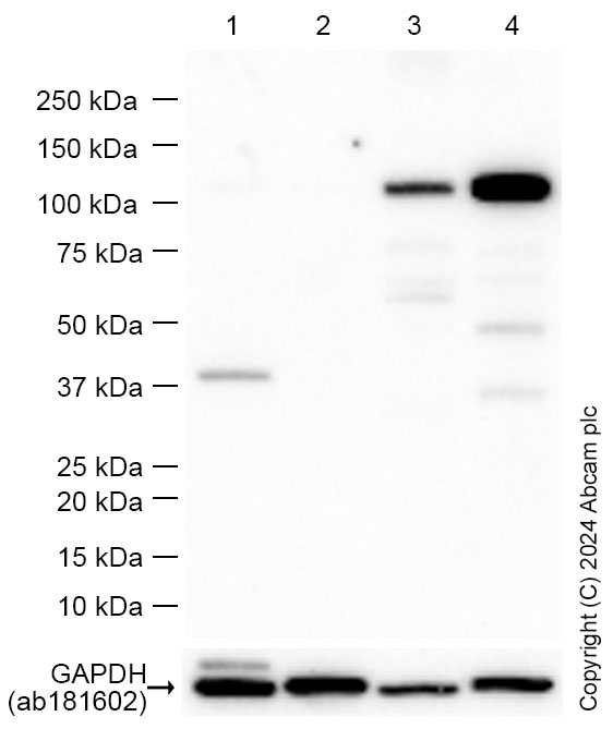 Western blot - Anti-Androgen Receptor antibody [SP107] - N-terminal (ab105225), expandable thumbnail