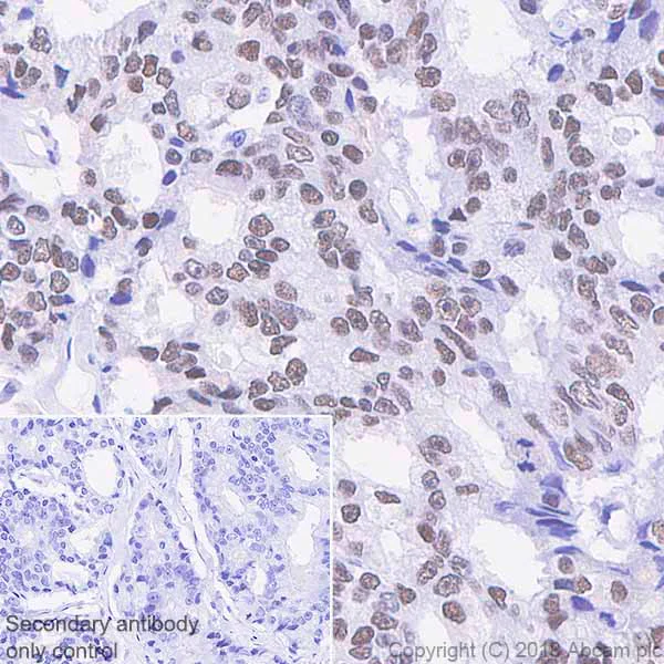 Immunohistochemistry (Formalin/PFA-fixed paraffin-embedded sections) - Anti-Androgen Receptor antibody [SP242] - BSA and Azide free (AB236237)