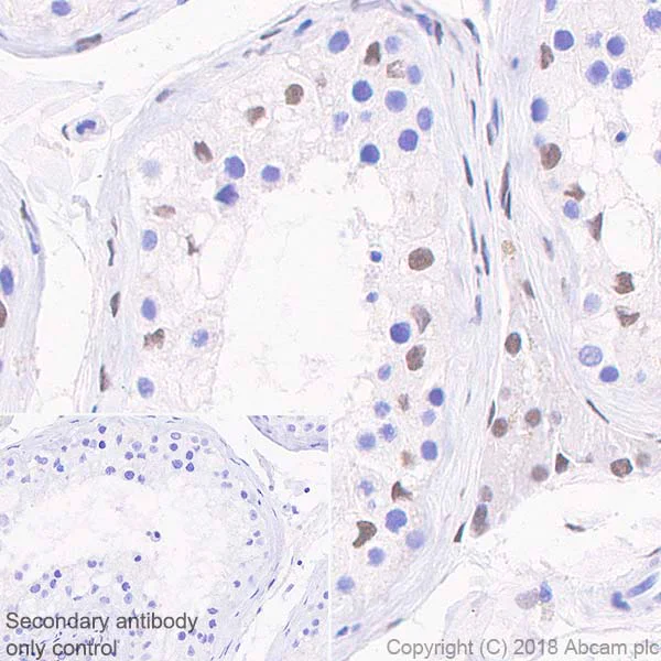 Immunohistochemistry (Formalin/PFA-fixed paraffin-embedded sections) - Anti-Androgen Receptor antibody [SP242] - BSA and Azide free (AB236237)