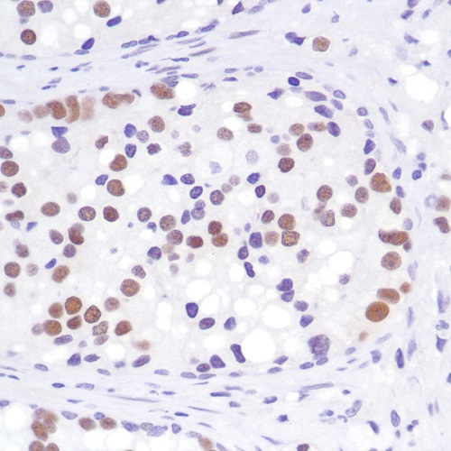 Immunohistochemistry (Formalin/PFA-fixed paraffin-embedded sections) - Anti-Androgen Receptor antibody [SP242] - BSA and Azide free (AB236237)