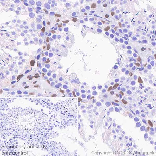 Immunohistochemistry (Formalin/PFA-fixed paraffin-embedded sections) - Anti-Androgen Receptor antibody [SP242] - BSA and Azide free (AB236237)