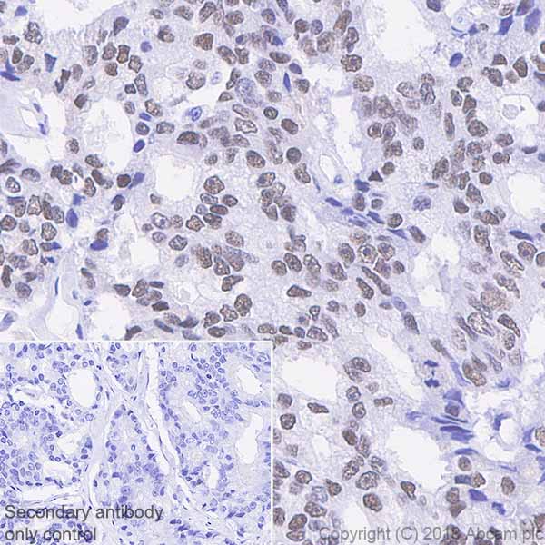 Immunohistochemistry (Formalin/PFA-fixed paraffin-embedded sections) - Anti-Androgen Receptor antibody [SP242] - C-terminal (AB227678), expandable thumbnail