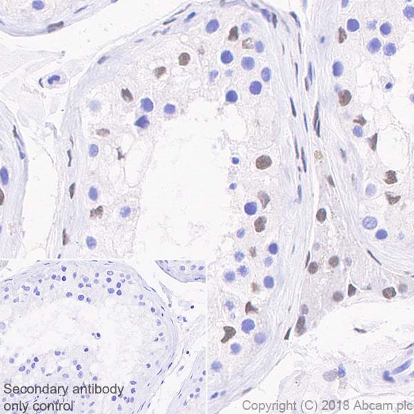 Immunohistochemistry (Formalin/PFA-fixed paraffin-embedded sections) - Anti-Androgen Receptor antibody [SP242] - C-terminal (AB227678), expandable thumbnail