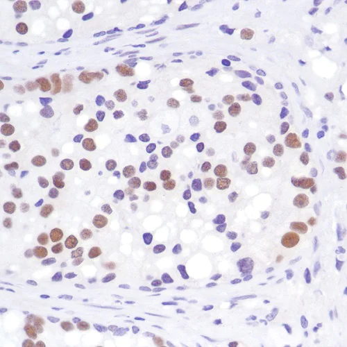 Immunohistochemistry (Formalin/PFA-fixed paraffin-embedded sections) - Anti-Androgen Receptor antibody [SP242] - C-terminal (AB227678)