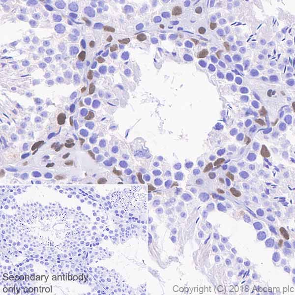 Immunohistochemistry (Formalin/PFA-fixed paraffin-embedded sections) - Anti-Androgen Receptor antibody [SP242] - C-terminal (AB227678), expandable thumbnail