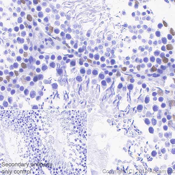Immunohistochemistry (Formalin/PFA-fixed paraffin-embedded sections) - Anti-Androgen Receptor antibody [SP242] - C-terminal (AB227678), expandable thumbnail
