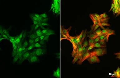 Immunocytochemistry/ Immunofluorescence - Anti-Androgen Receptor ARv7 Splice Variant antibody [HL1028] (AB308335)