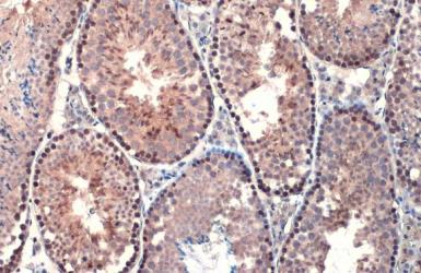 Immunohistochemistry paraffin embedded sections - Anti-Androgen Receptor ARv7 Splice Variant antibody [HL1028] (AB308335), expandable thumbnail
