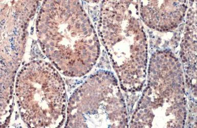 Immunohistochemistry paraffin embedded sections - Anti-Androgen Receptor ARv7 Splice Variant antibody [HL1028] (AB308335)