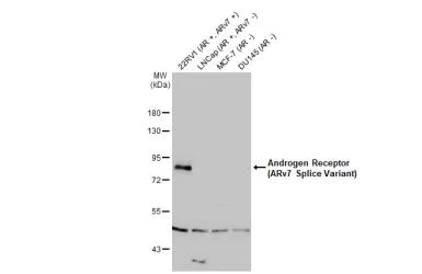 Western blot - Anti-Androgen Receptor ARv7 Splice Variant antibody [HL1028] (AB308335)