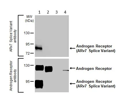 Anti-Androgen Receptor ARv7 Splice Variant 抗体 [HL1028] (ab308335) | Abcam