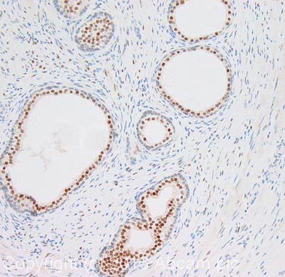 Immunohistochemistry (Formalin/PFA-fixed paraffin-embedded sections) - Anti-Androgen Receptor (phospho S210 + S213) antibody [156C135.2] (AB45089)