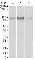 Western blot - Anti-Androgen Receptor (phospho S210 + S213) antibody [156C135.2] (AB45089)
