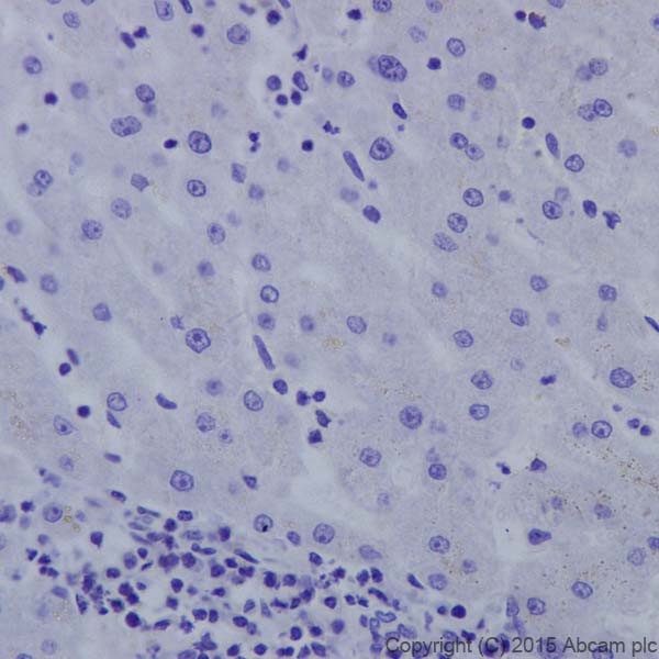 Immunohistochemistry (Formalin/PFA-fixed paraffin-embedded sections) - Anti-Androgen receptor variant 5,6,7es antibody [EPR15657] (AB200827)