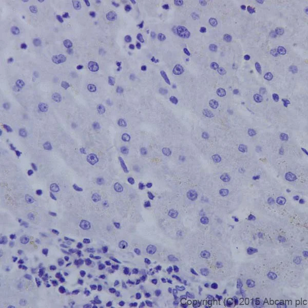 Immunohistochemistry (Formalin/PFA-fixed paraffin-embedded sections) - Anti-Androgen receptor variant 5,6,7es antibody [EPR15657] (AB200827)