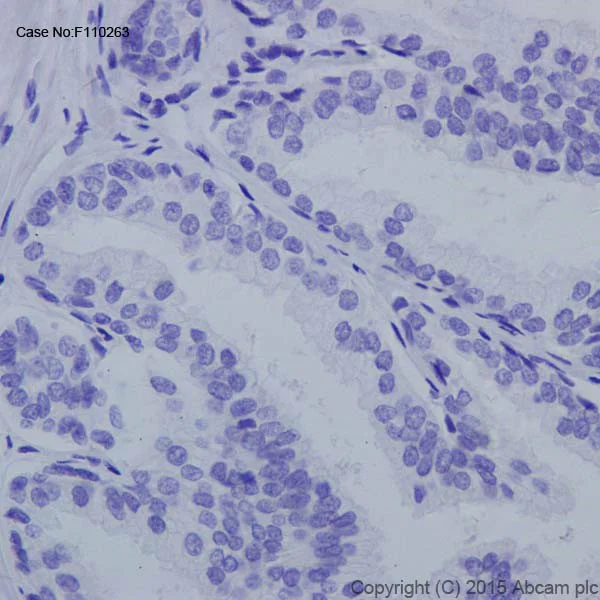 Immunohistochemistry (Formalin/PFA-fixed paraffin-embedded sections) - Anti-Androgen receptor variant 5,6,7es antibody [EPR15657] (AB200827)