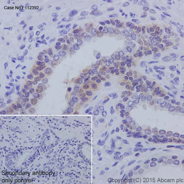 Immunohistochemistry (Formalin/PFA-fixed paraffin-embedded sections) - Anti-Androgen receptor variant 5,6,7es antibody [EPR15657] (AB200827)