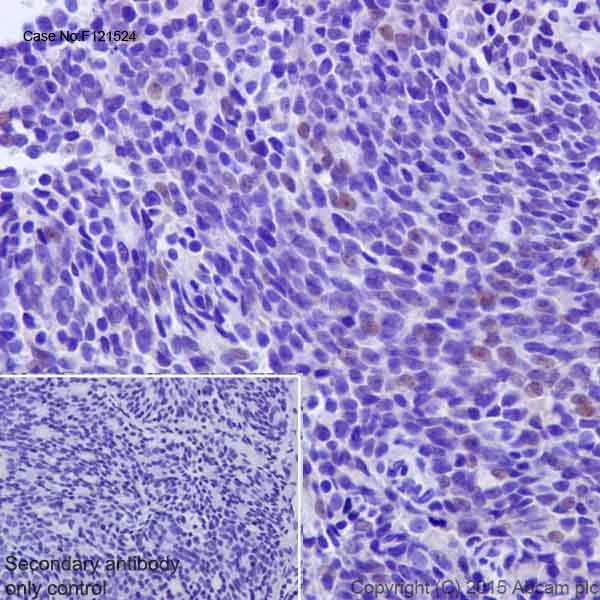 Immunohistochemistry (Formalin/PFA-fixed paraffin-embedded sections) - Anti-Androgen receptor variant 5,6,7es antibody [EPR15657] (AB200827)