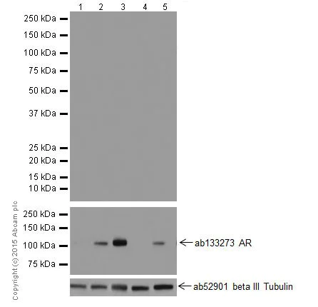 Western blot - Anti-Androgen receptor variant 5,6,7es antibody [EPR15657] (AB200827)