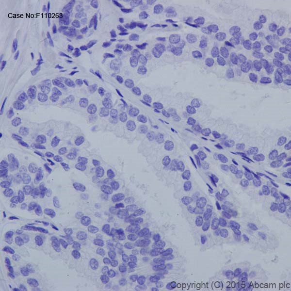Immunohistochemistry (Formalin/PFA-fixed paraffin-embedded sections) - Anti-Androgen receptor variant 5,6,7es antibody [EPR15657] - BSA and Azide free (AB251320), expandable thumbnail