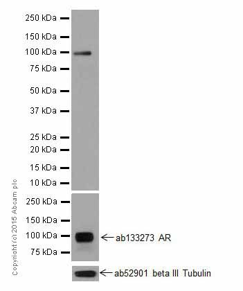 Western blot - Anti-Androgen receptor variant 5,6,7es antibody [EPR15657] - BSA and Azide free (AB251320), expandable thumbnail