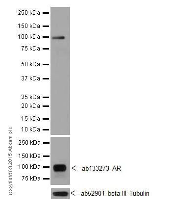 Western blot - Anti-Androgen receptor variant 5,6,7es antibody [EPR15657] - BSA and Azide free (AB251320)