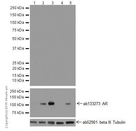 Western blot - Anti-Androgen receptor variant 5,6,7es antibody [EPR15657] - BSA and Azide free (AB251320), expandable thumbnail