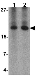 Western blot - Anti-Angiogenin antibody (AB139947), expandable thumbnail