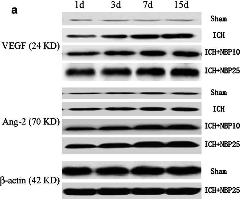 Western blot - Anti-Angiogenin antibody (AB139947)